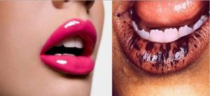 The effect of lead on lips