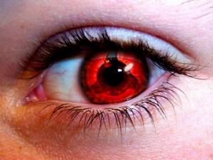 Extravagance or mistake of choice: advantages and disadvantages of red lenses. Is there any harm in wearing them? 