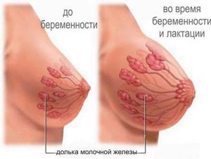 Изменение груди после родов