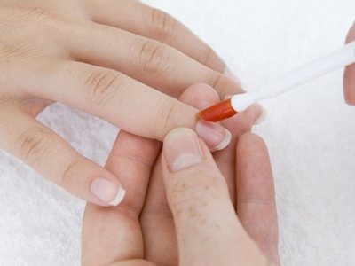 How to get rid of hangnails forever