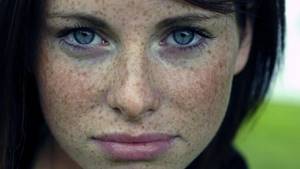 How to remove age spots. How to get rid of freckles 