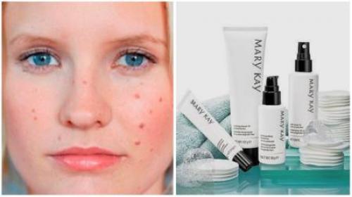 How to take care of facial skin at 13 years old. How to deal with acne 