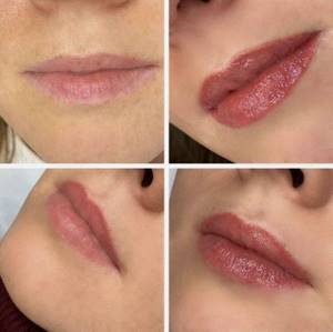 Как заживают губы после татуажа - Перманентный макияж губ