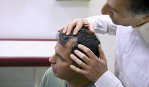 treatment for baldness