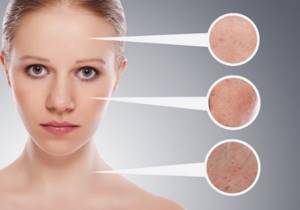 What causes pigment spots? Reasons and how to get rid of them. Treatment 