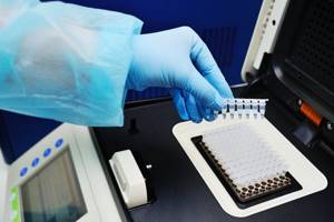 PCR for sexually transmitted diseases