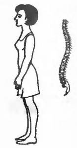 Correct posture. With correct posture, the natural curves of the spine are preserved and muscle tone is minimal 