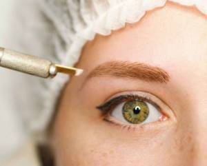 Contraindications for eyebrow tattooing