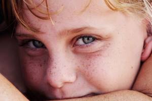 Child with freckles