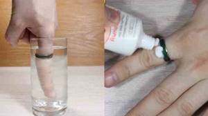 Remove the ring using cream or cold water