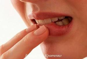 Cracks on the lips - causes and treatment at home