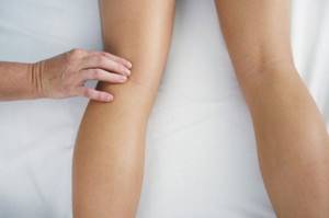 Varicose veins in the legs, symptoms and treatment of blockage...