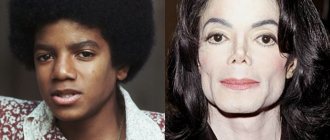 Age, angle or rhinoplasty: 10 male stars whose noses have changed - Michael Jackson