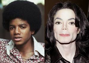 Age, angle or rhinoplasty: 10 male stars whose noses have changed - Michael Jackson