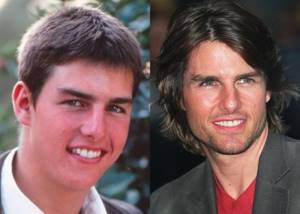 Age, angle or rhinoplasty: 10 male stars whose noses have changed - Tom Cruise