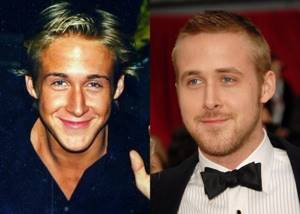 Age, angle or rhinoplasty: 10 male stars whose noses have changed - Ryan Gosling