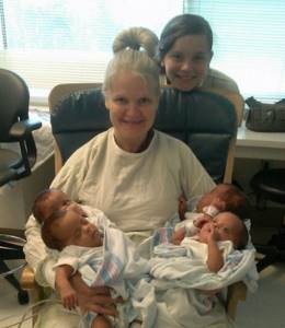 A 42-year-old woman was expecting triplets, but during childbirth the doctor says: More legs